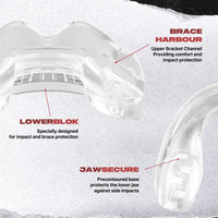 Safejawz Apparecchi Braces Mouthguard